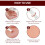 Wipeoff Tags & Moles Remover,Wipeoff Tags & Moles Remove,Quick & Safe Remove 3