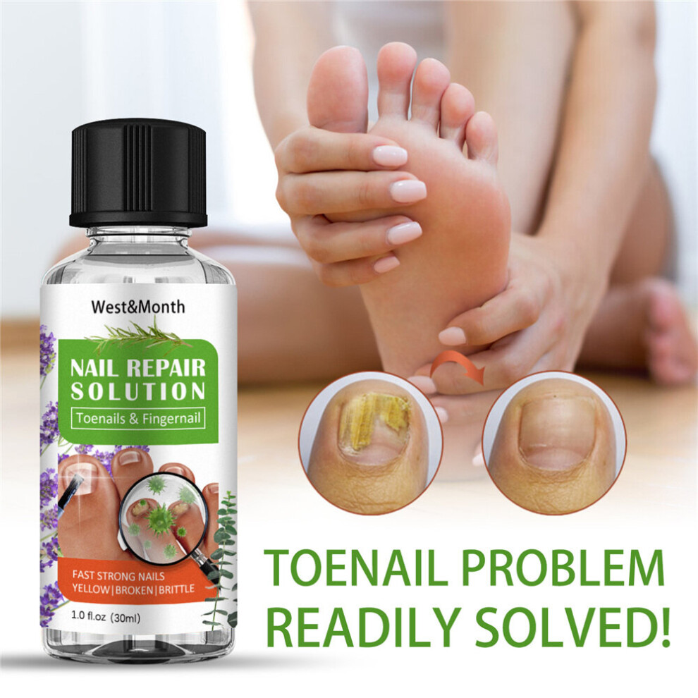 (1 Pc) 30ml Nail Repair Solution Tea Tree Oil Herbal Liquid For Toenails Fingernail Treatment
