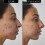 | Retinol 1% Serum | Supersolutions | 30ml 4