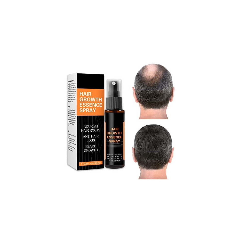 Hair Regrowth Spray,Hair Growth Serum,Hair Regrowth Treatment for Men & Women Hair Rapid Growth Dens,Anti Hair Loss,Natural Ingredients Hair Regrowth