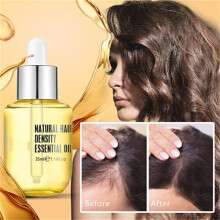 Natural Hair Density Essential Oil For Women & Men