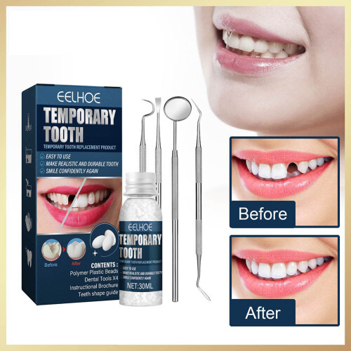 Temporary Tooth Repair Beads Missing Broken Teeth Filling Material Repair Dental Tools 1