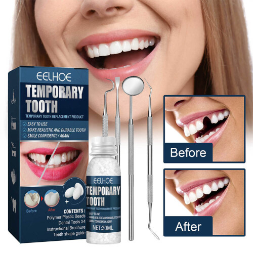 Temporary Tooth Repair Beads Missing Broken Teeth Filling Material Repair Dental Tools