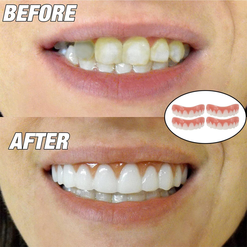 Aihontai Teeth Veneers Denture Teeth Whitening Braces Toy Fake Tooth Cover Beauty