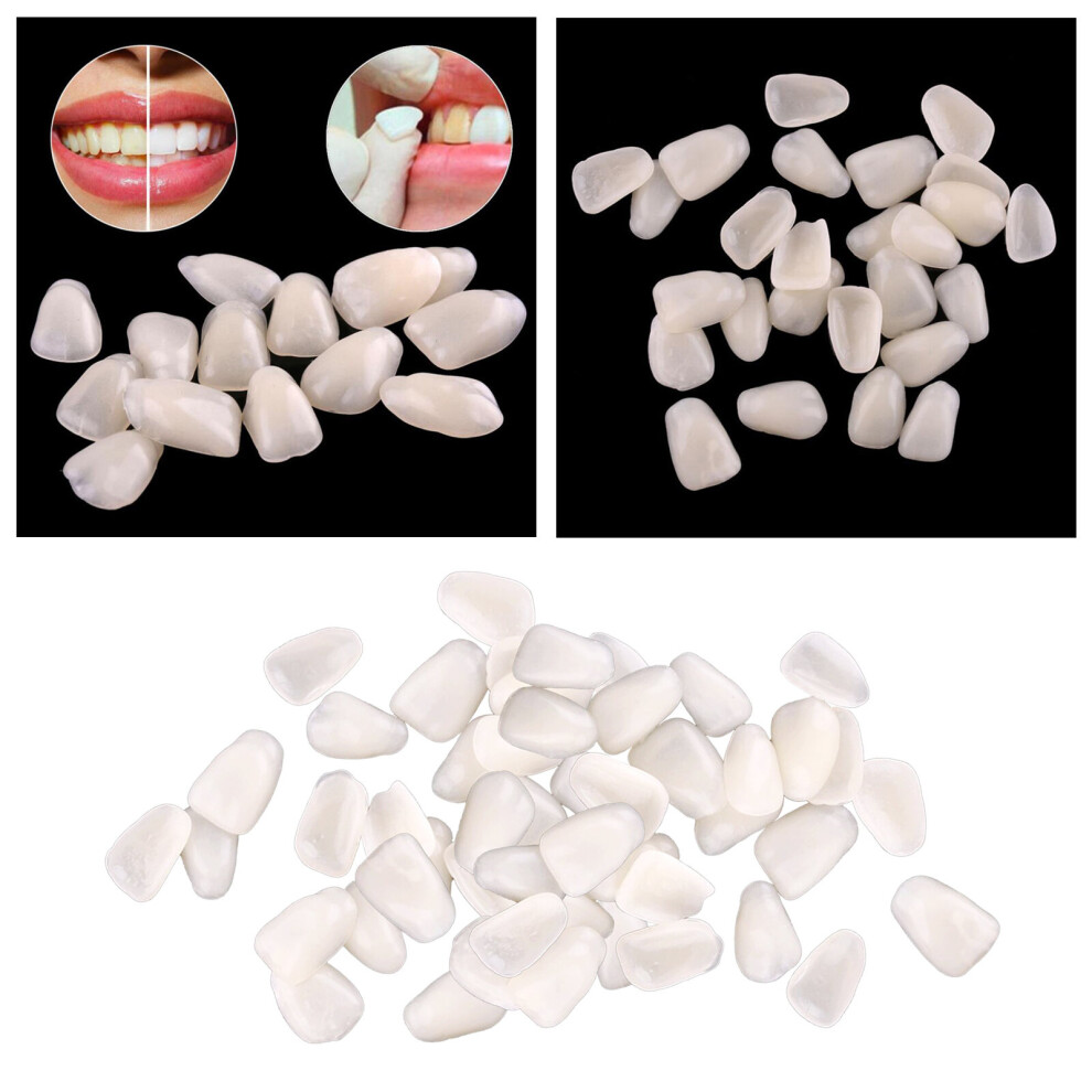 Aihontai Beige (Beige) Temporary Crown Ultra Thin Resin Whitening Teeth Anterior Tooth Veneers