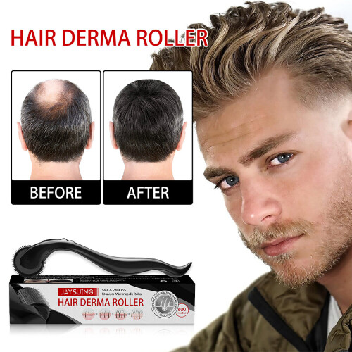 Derma Roller Titanium Mikronålar – Hårbottenmassage & Vård – Främjar skägg- och håråterväxt 2