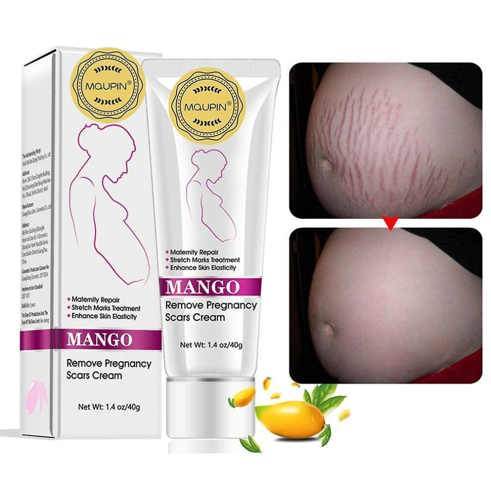 Funkyn Cream Mango Stretch Marks And Scar -Stretch Marks And Scar Removal For Pregnancy - Best Body Moisturizer-40G