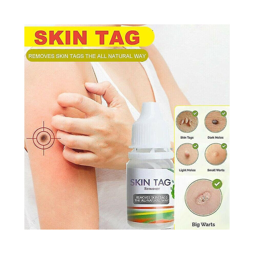 New Safe Fast Skin Tag Remover Liquid Mole Wart Acne Pimple Patch Removal Spot