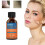 Skin Tag Removal Treatment Liquid Face Care Mole Remover Wart Solution 2