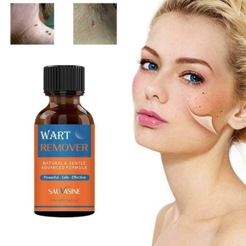Skin Tag Removal Treatment Liquid Face Care Mole Remover Wart Solution 1