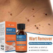 Skin Tag Removal Treatment Liquid Face Care Mole Remover Wart Solution
