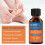 Skin Tag Removal Treatment Liquid Face Care Mole Remover Wart Solution 3