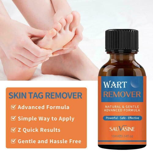 Skin Tag Removal Treatment Liquid Face Care Mole Remover Wart Solution 2