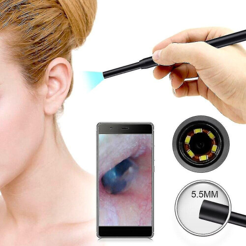 Wifi Cleaning Endoscope Smart Vision Otoscope Camera 2