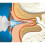 Mack's - ProRinse Earwax Removal System 7