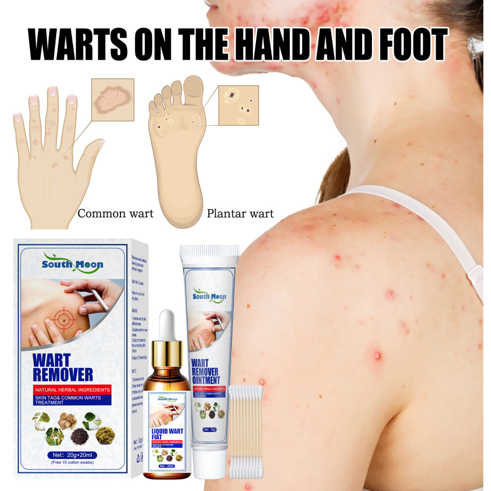Skesrjtop Cream Cleansing And Wart Remover For Facial Axillary Granulation And Filamentous Warts