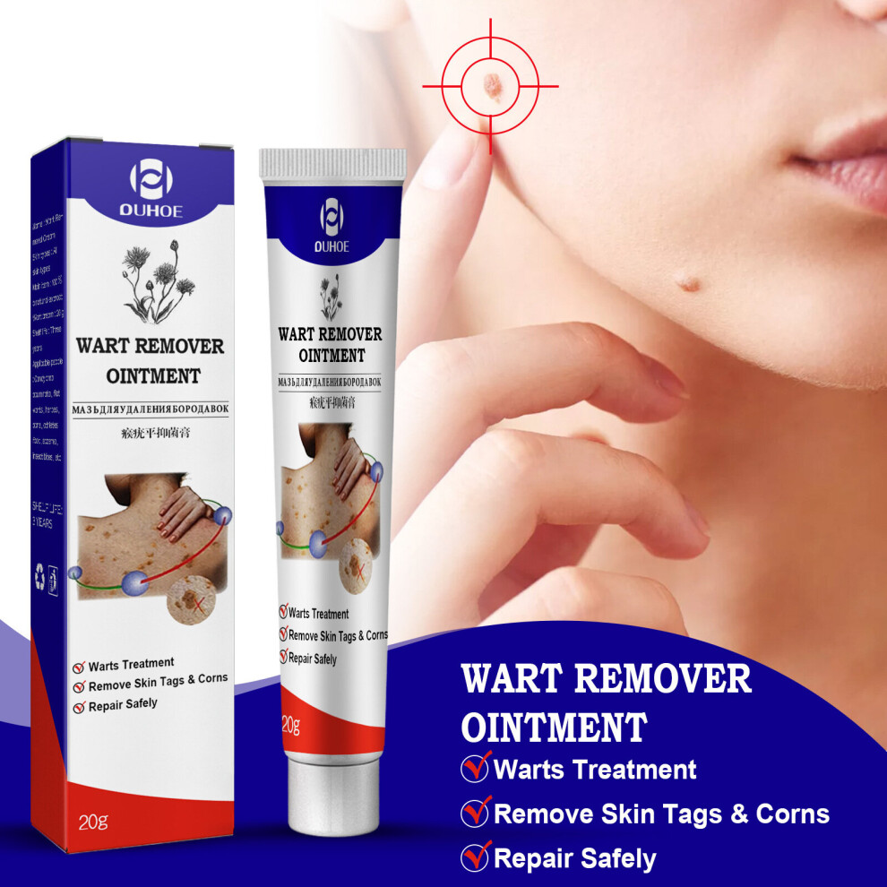 Skesrjtop Cream Ouhoe Wart Leveling Ke Wart Skin Topical Ointment, Filamentous Wart Leveling