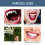 Halloween Vampire Makeup, Artificial Teeth Decoration, Dental Gel Set 3