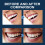 Halloween Vampire Makeup, Artificial Teeth Decoration, Dental Gel Set 4