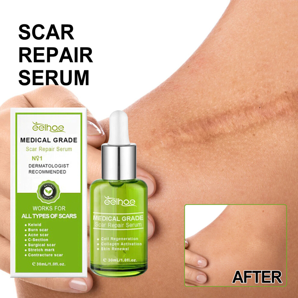 Yetp Star Efero Scar Removal Essence Acne Stretch Marks Natural Skin Repair Fade Scars