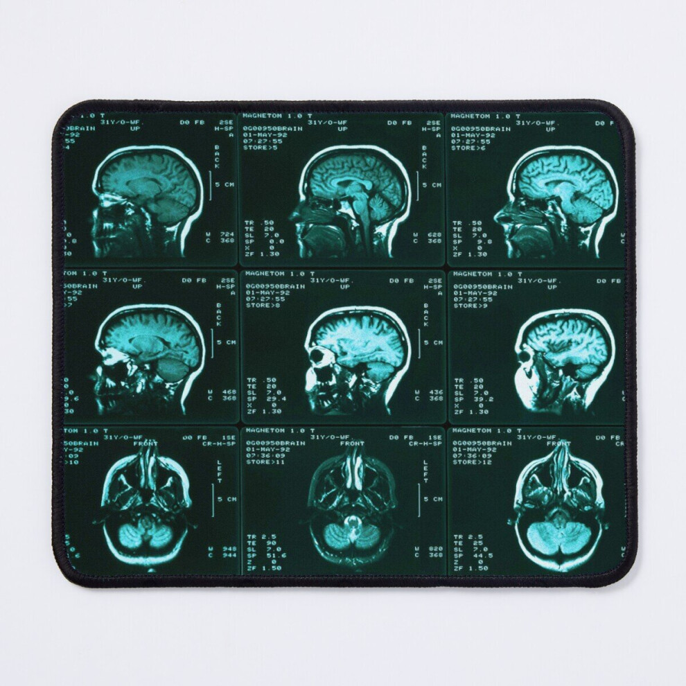 Mouse Pad Mri Of Normal Brain, Medical Imaging 11.8 X 9.8 Inch Computer Mat Gaming Office Mousepad 7802738162943