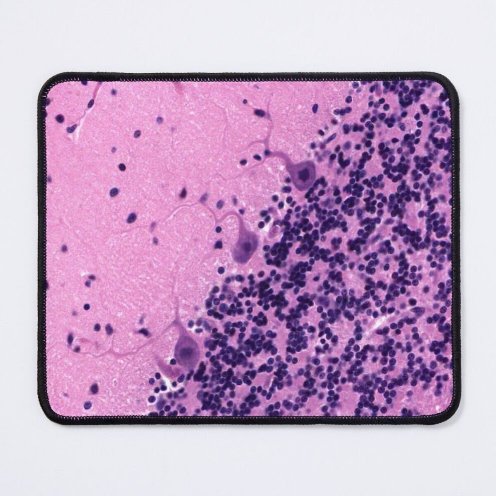 Mouse Pad Cerebellum Of The Brain 11.8 X 9.8 Inch Computer Mat Gaming Office Mousepad 7802738179224