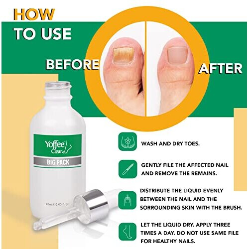 Clear Nail Repair and Care 60ml Fungal Nail treatment for fingernails