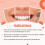 Permanent Luting  Dental Cement, Ready to Use Tooth Filling Repair Kit 4