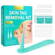 (a-GN) Skin Tag Remover Device Painless Mole Wart Remover Includes Removal Bands Cleansing Wipes Application in Minutes