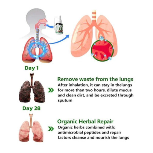 Respinature Herbal Lung Cleanse Mist-Powerful Lung Support 1