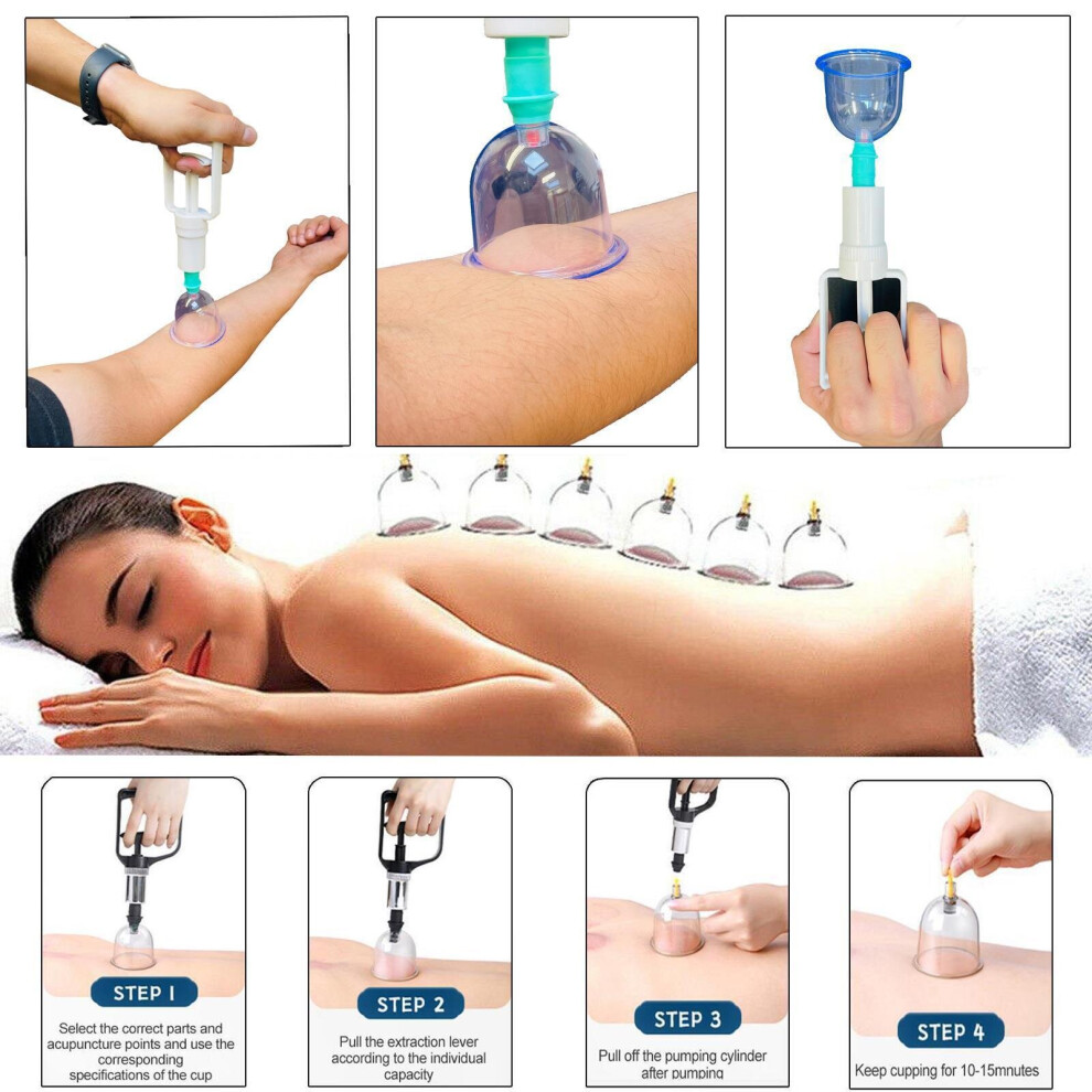 12PCS Cupping Therapy Set Vaccuum Massage Cups