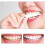 Snap on Teeth Veneers,Perfect Teeth Temporary Replacement Fake Veneers Kit-2 Boxes 5