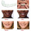 Snap on Teeth Veneers,Perfect Teeth Temporary Replacement Fake Veneers Kit-2 Boxes 2