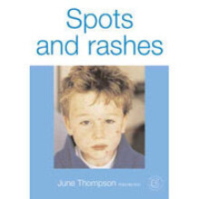 Spots and Rashes