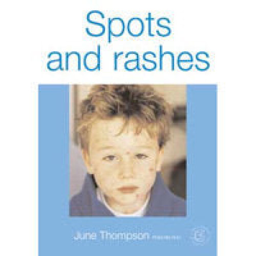 Spots and Rashes