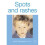 Spots and Rashes 2
