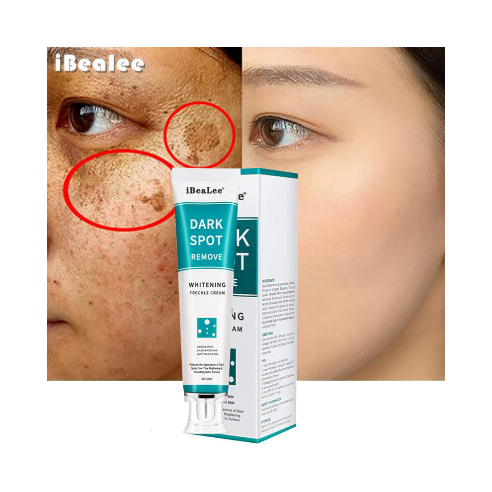 iBeaLee Whitening Freckle Cream Remove Melasma Dark Spots Cream Anti-Aging 20ml