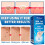 iBeaLee Skin Tag Remover Fast Effective Safe 20ml. 4