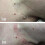 iBeaLee Skin Tag Remover Fast Effective Safe 20ml. 8