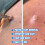 iBeaLee Skin Tag Remover Fast Effective Safe 20ml. 10