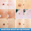 iBeaLee Skin Tag Remover Fast Effective Safe 20ml. 12