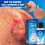 iBeaLee Skin Tag Remover Fast Effective Safe 20ml. 9
