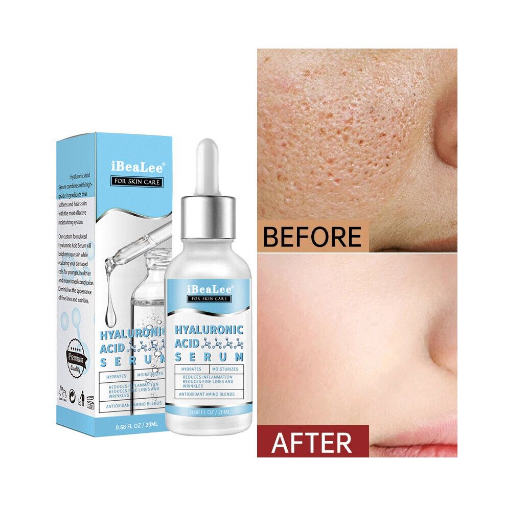 iBeaLee Hyaluronic Acid Serum Anti Wrinkle Facial Moisturizing 20ml