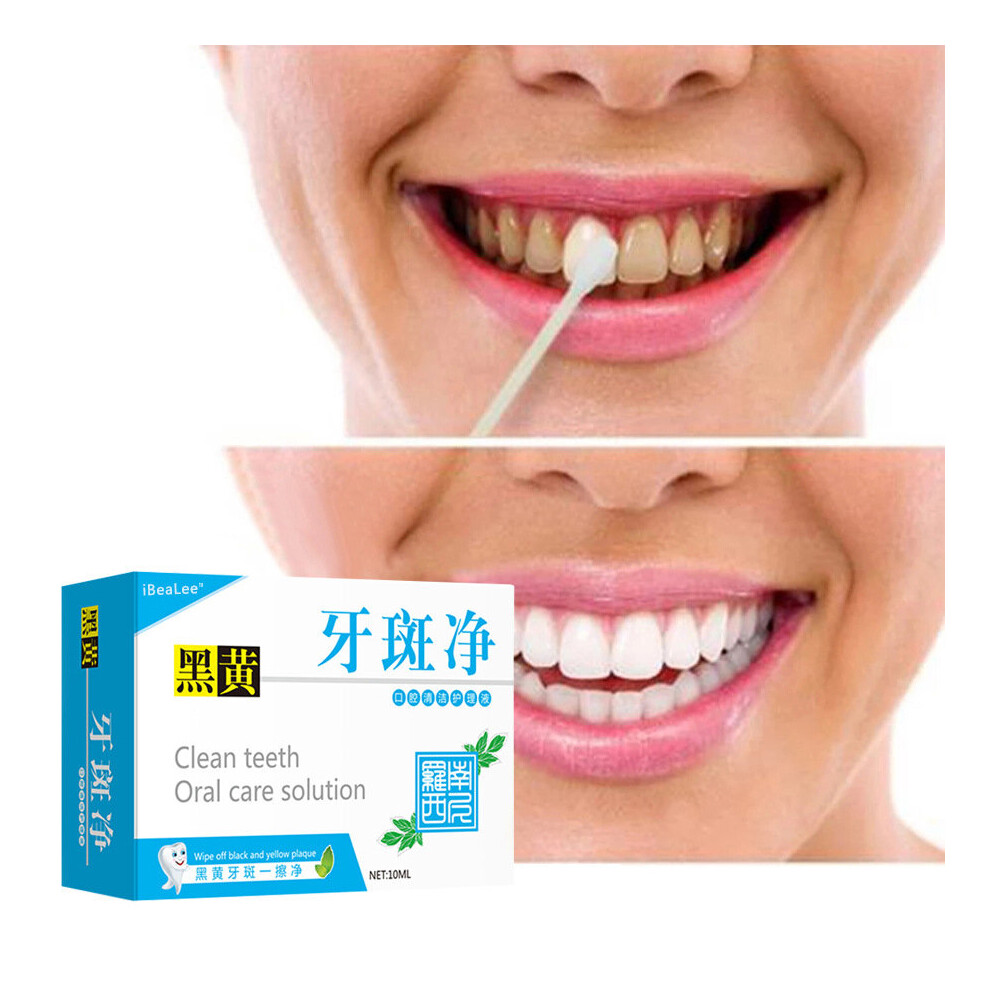 Clean Teeth Oral Care Solution Whiten Teeth Remove Plaque Stains Fresh Breath Oral Hygiene Dental Tools