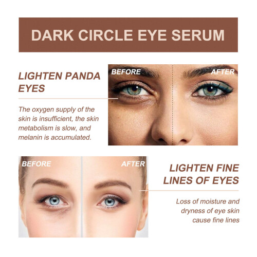 Dark Circle Anti-aging Rapid Reduction Eye Serum 20ml 1