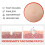 Blusoms Microdarts Tag'gone Patch,neutroera Blusoms Pro Microdarts Taggone Patch 2