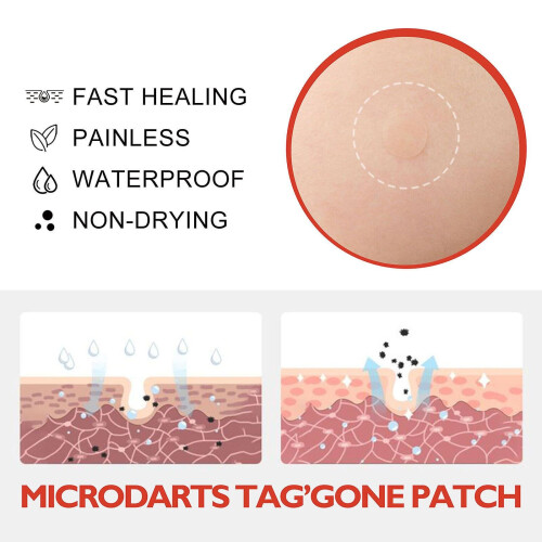 Blusoms Microdarts Tag'gone Patch,neutroera Blusoms Pro Microdarts Taggone Patch 1