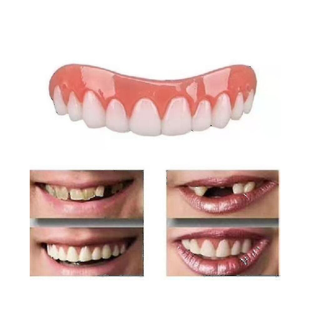 2 Sets Of Dentures, Upper And Lower Jaw Dentures, Natural And Comfortable, Protect The Teeth, And Regain A Confident Smile