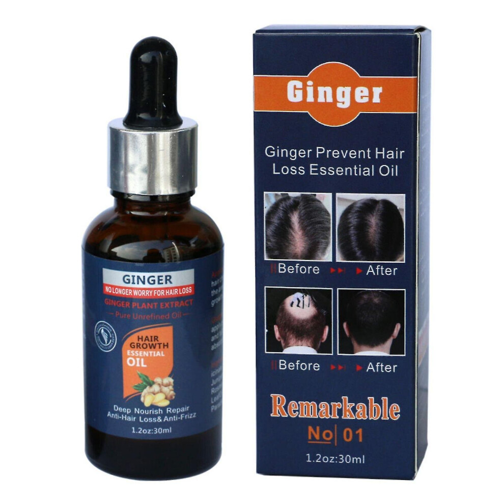 Garlic Hair Nutrient Solution To Prevent And Nourish Scalp Hair Growth Solution 50ml