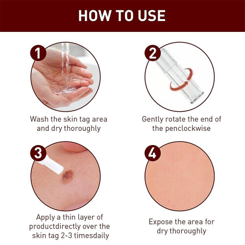 3pcs Wipe Off Skin Tags 1
